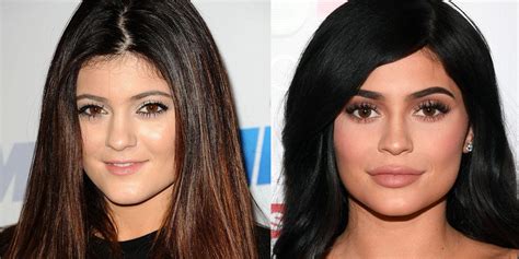 Plastic Surgery Before and After Photo Gallery 